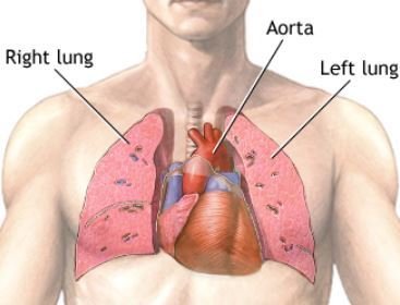 Lungs Disease Treatment