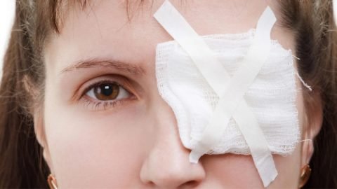 Eye Injuries