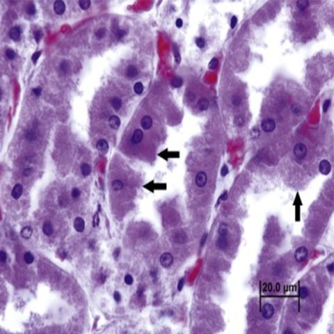 Apoptosis and Programmed Cell Death